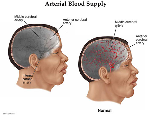 Arterial Blood Supply